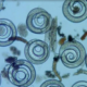 trichinella spiralis